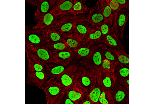 Immunofluorescence Image 1: Mono-Methyl-Histone H3 (Lys9) (D1P5R) Rabbit mAb