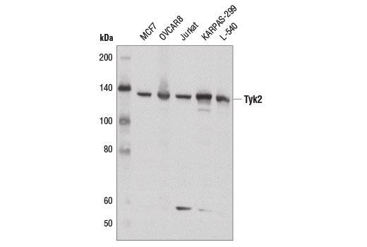  Image 1: Phospho-Jak Family Antibody Sampler Kit