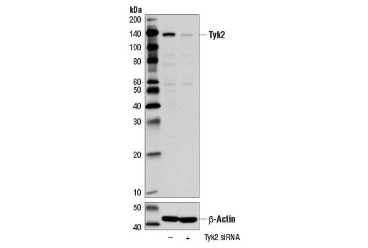  Image 25: IFN (Type I/III) Signaling Pathway Antibody Sampler Kit