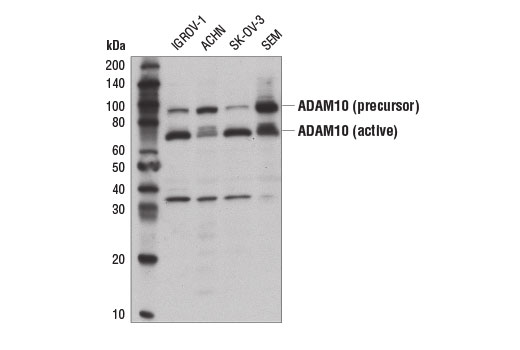 Western Blotting Image 1: ADAM10 Antibody