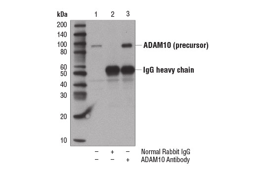Immunoprecipitation Image 1: ADAM10 Antibody