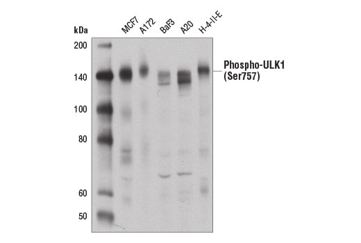  Image 5: PhosphoPlus® ULK1 (Ser757) Antibody Duet