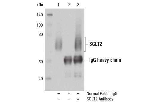 Immunoprecipitation Image 1: SGLT2 Antibody