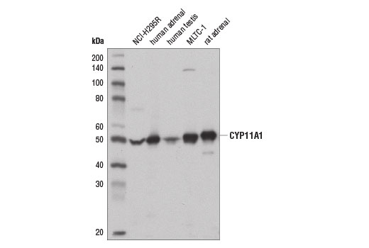 Western Blotting Image 1: CYP11A1 (D8F4F) Rabbit mAb
