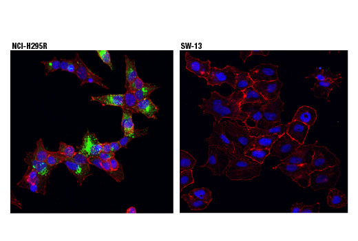 Immunofluorescence Image 1: CYP11A1 (D8F4F) Rabbit mAb
