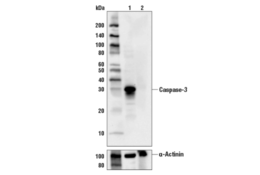 Image 11: Apoptosis/Necroptosis Antibody Sampler Kit