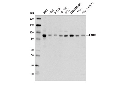  Image 2: Fanconi Anemia Antibody Sampler Kit