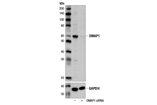  Image 1: SignalSilence® DMAP1 siRNA I