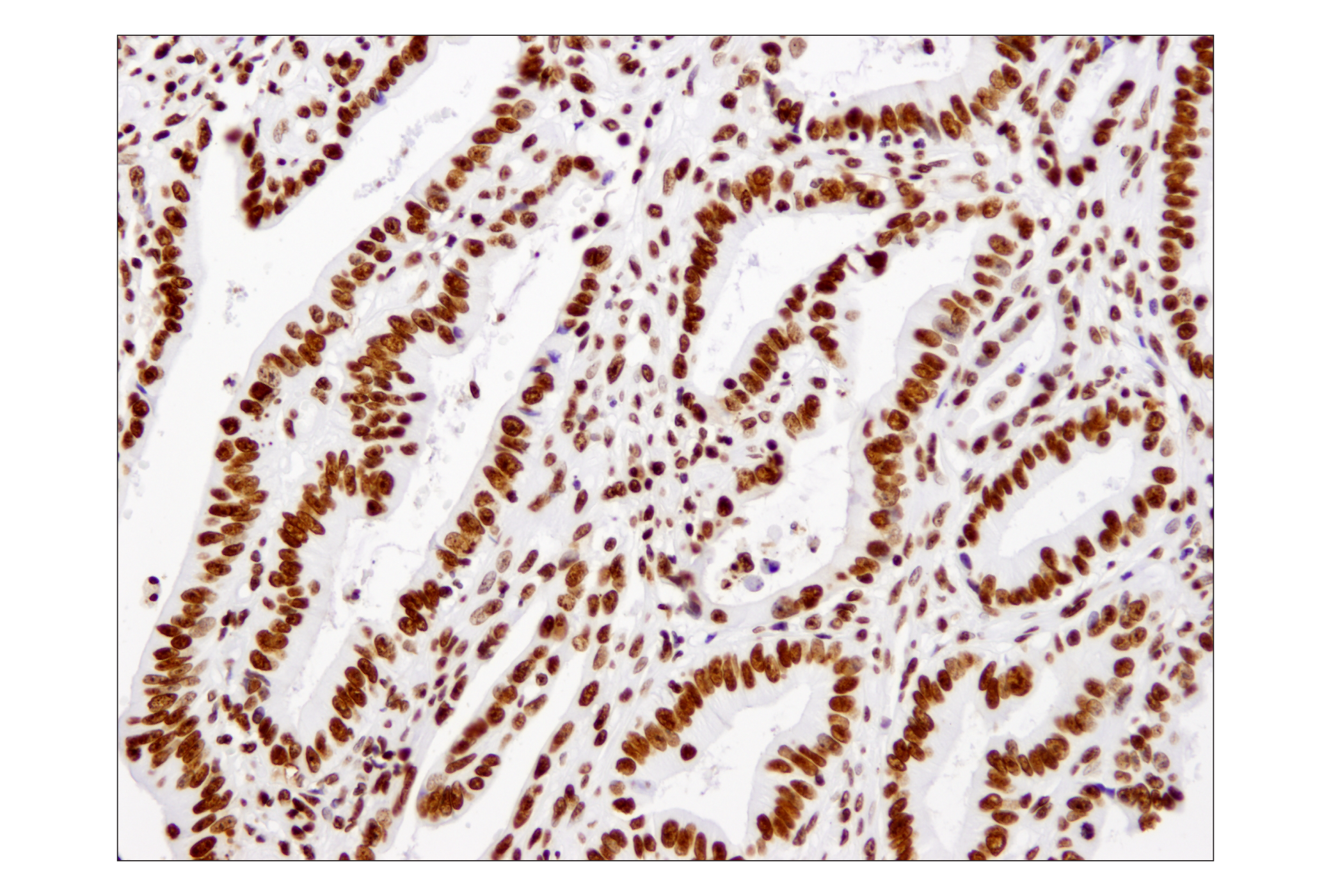 Immunohistochemistry Image 2: Histone H3 (1B1B2) Mouse mAb