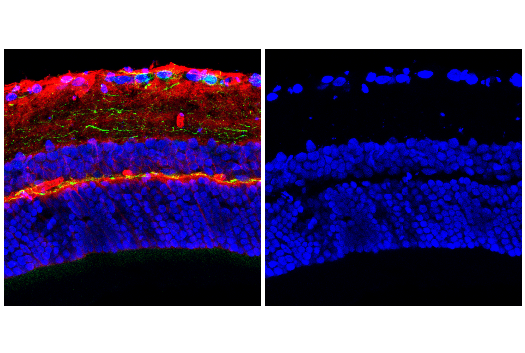 Immunofluorescence Image 1: Histone H3 (1B1B2) Mouse mAb