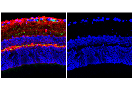 Immunofluorescence Image 1: Histone H3 (1B1B2) Mouse mAb