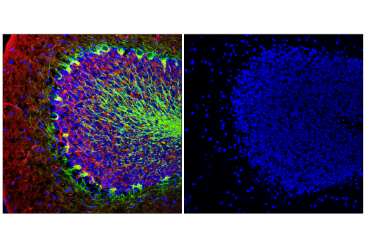 Immunofluorescence Image 2: Histone H3 (1B1B2) Mouse mAb