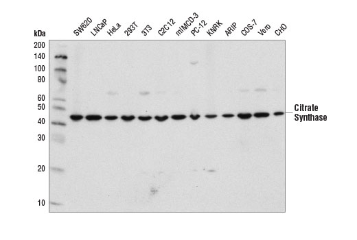 Western Blotting Image 1: Citrate Synthase (D7V8B) Rabbit mAb
