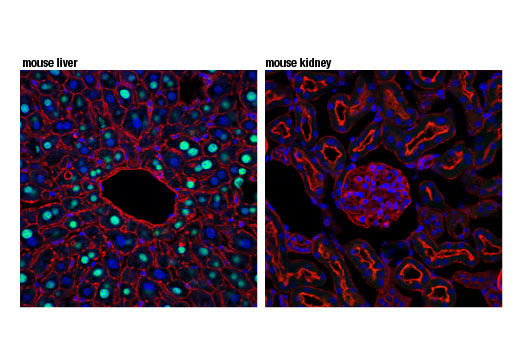 Immunofluorescence Image 1: GCKR (D1W9P) Rabbit mAb