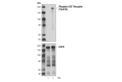 Western Blotting Image 1: Phospho-EGF Receptor (Thr678) Antibody