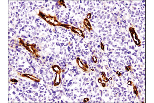 Immunohistochemistry Image 1: CD36 (D8L9T) Rabbit mAb