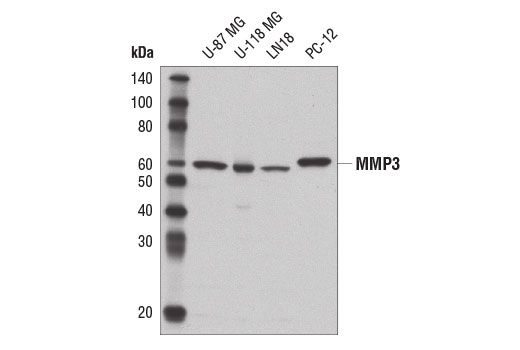  Image 3: ECM Profiling Antibody Sampler Kit