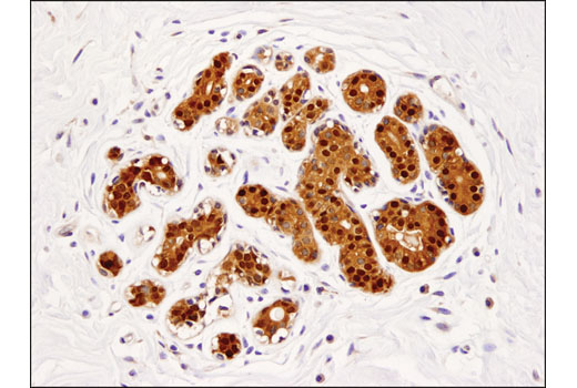 Immunohistochemistry Image 1: COMT (D4N6M) Rabbit mAb