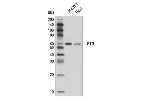 Western Blotting Image 1: FTO Antibody
