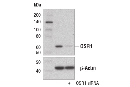  Image 1: SignalSilence® OSR1 siRNA I