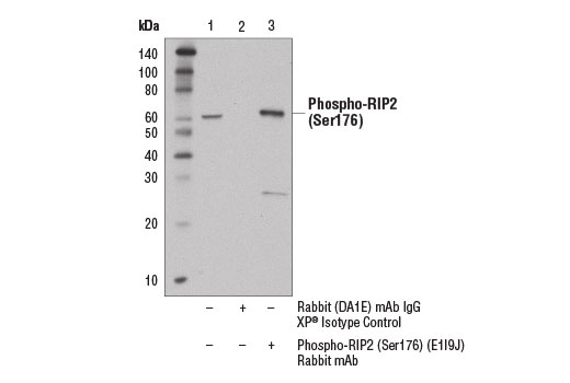 Immunoprecipitation Image 1: Phospho-RIP2 (Ser176) (E1I9J) Rabbit mAb