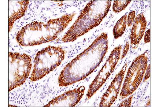 Immunohistochemistry Image 1: EpCAM (D9S3P) Rabbit mAb (IHC Preferred)
