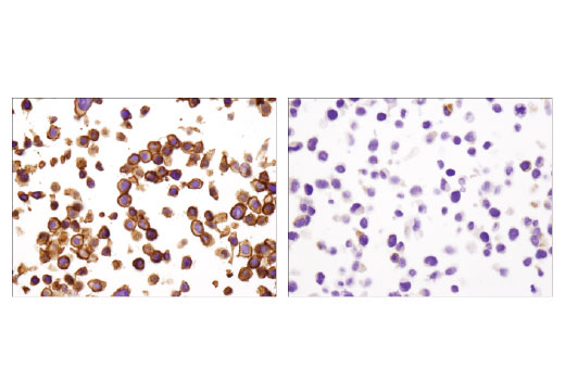 Immunohistochemistry Image 5: EpCAM (D9S3P) Rabbit mAb (IHC Preferred)