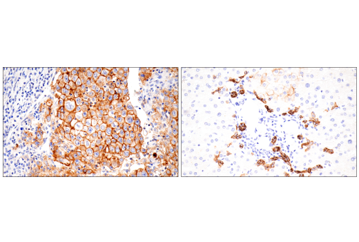 Immunohistochemistry Image 4: EpCAM (D9S3P) Rabbit mAb (IHC Preferred)