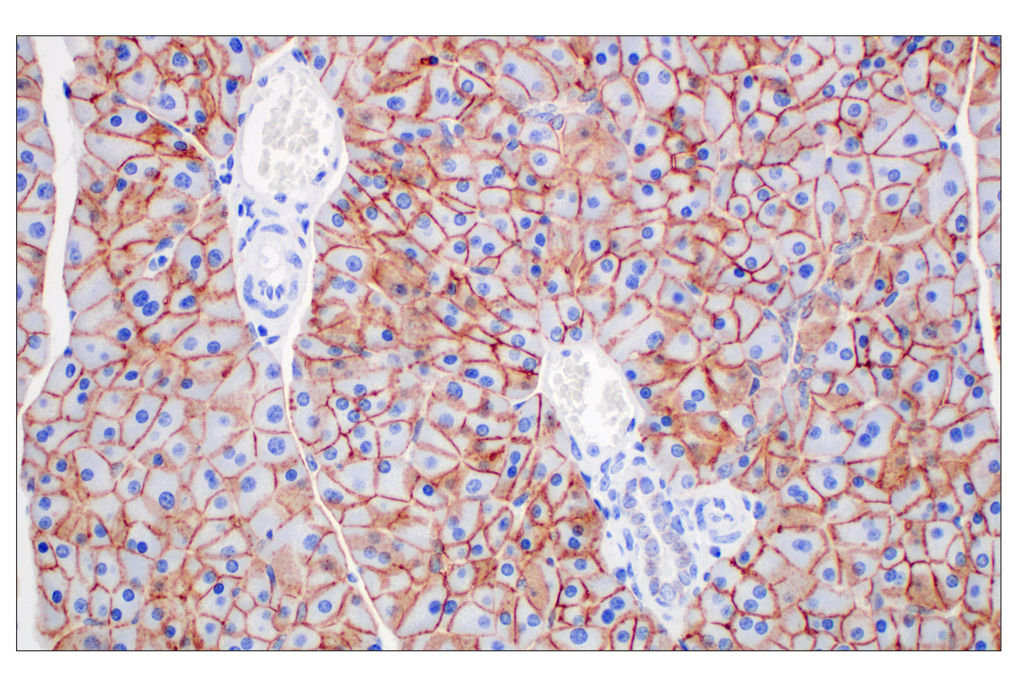 Immunohistochemistry Image 1: EpCAM (D9S3P) Rabbit mAb