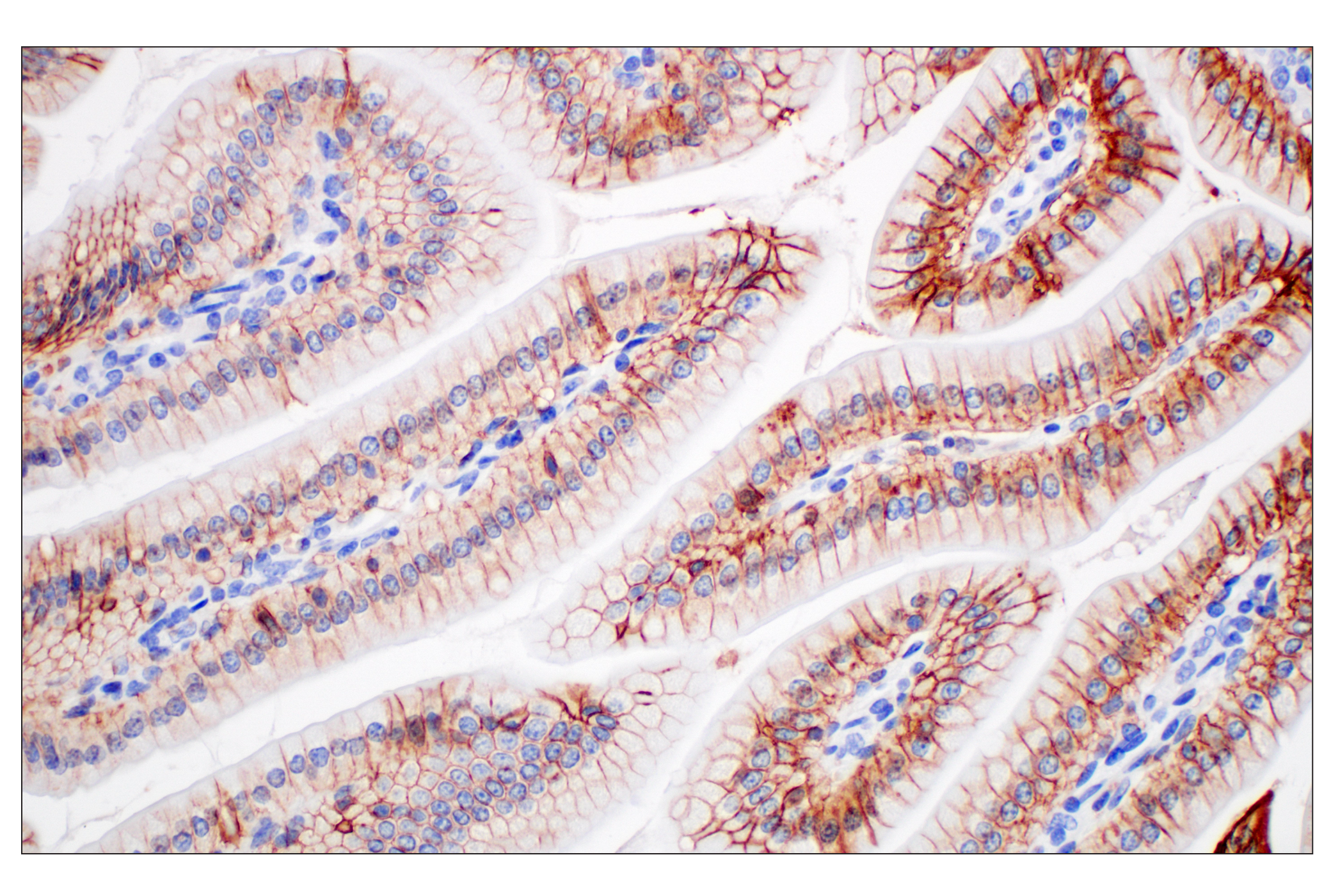 Immunohistochemistry Image 2: EpCAM (D9S3P) Rabbit mAb