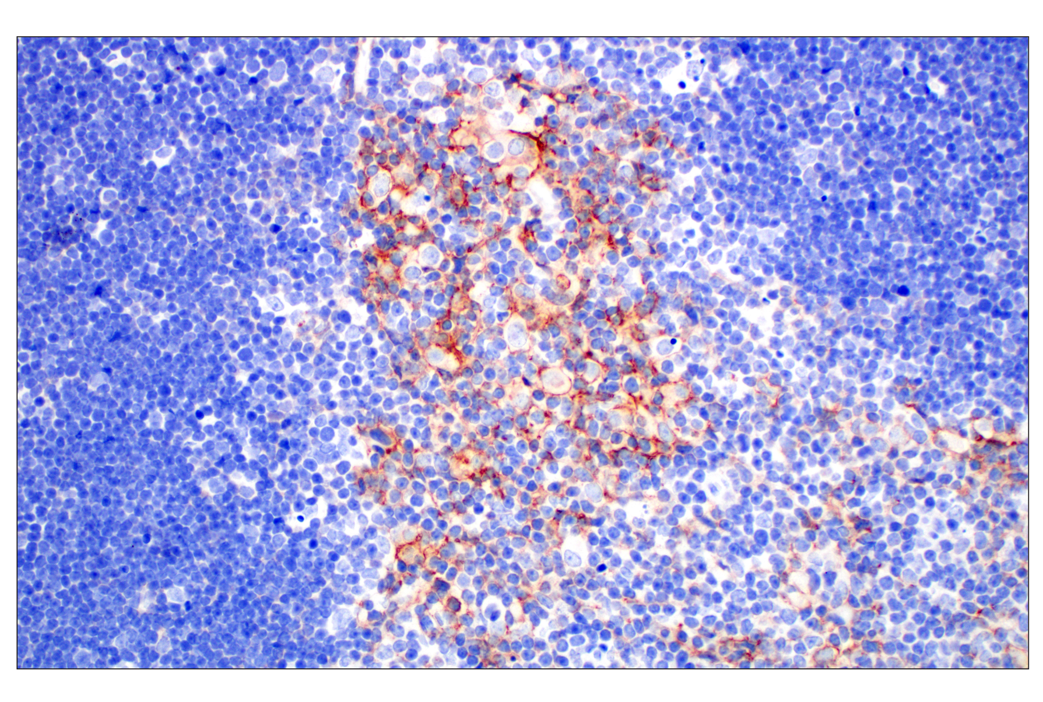 Immunohistochemistry Image 3: EpCAM (D9S3P) Rabbit mAb