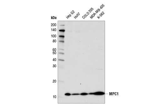  Image 4: Tricarboxylic Acid Cycle Antibody Sampler Kit
