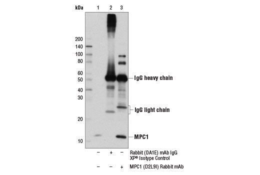  Image 20: Tricarboxylic Acid Cycle Antibody Sampler Kit