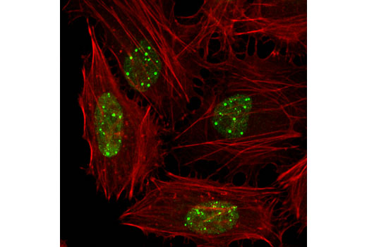 Immunofluorescence Image 1: ELL (D7N6U) Rabbit mAb