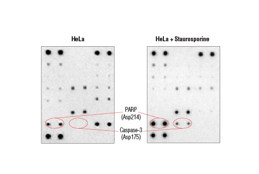  Image 4: PathScan® Intracellular Signaling Membrane Array Kit (Chemiluminescent Readout)