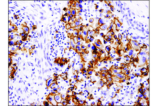 Immunohistochemistry Image 3: E-Cadherin (4A2) Mouse mAb