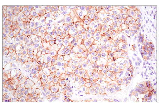 Immunohistochemistry Image 2: E-Cadherin (4A2) Mouse mAb