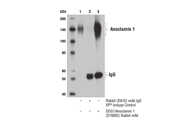 Immunoprecipitation Image 1: DOG1/Anoctamin 1 (D1M9Q) Rabbit mAb