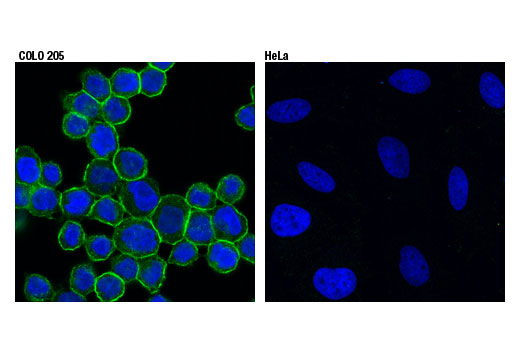 Immunofluorescence Image 1: DOG1/Anoctamin 1 (D1M9Q) Rabbit mAb