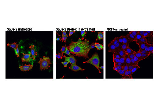 Immunofluorescence Image 1: CYR61 (D4H5D) XP® Rabbit mAb