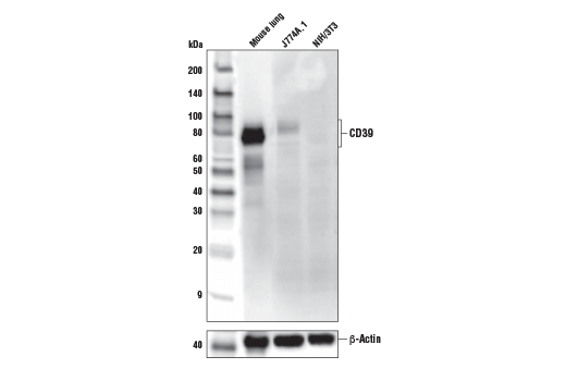 Western Blotting Image 1: CD39/NTPDase 1 (E2X6B) XP® Rabbit mAb (Mouse Specific)