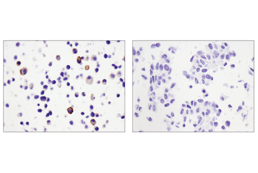 Immunohistochemistry Image 2: CD39/NTPDase 1 (E2X6B) XP® Rabbit mAb (Mouse Specific)