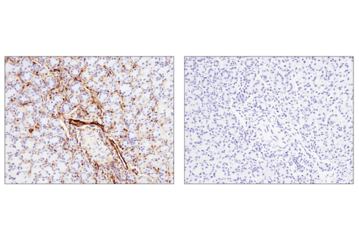 Immunohistochemistry Image 3: CD39/NTPDase 1 (E2X6B) XP® Rabbit mAb (Mouse Specific)