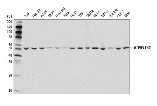 Western Blotting Image 1: ATP6V1B2 (D3O7Q) Rabbit mAb