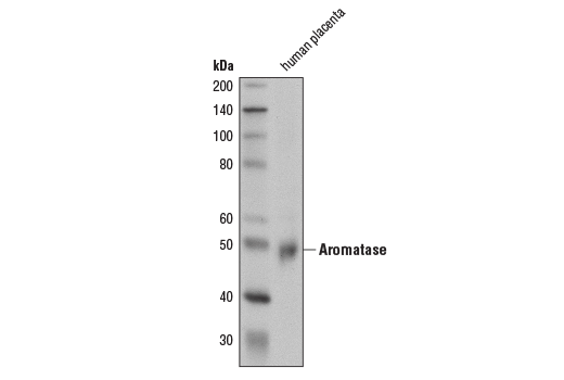 Western Blotting Image 1: Aromatase (D5Q2Y) Rabbit mAb
