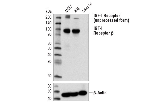 Western Blotting Image 1: IGF-I Receptor β (D4O6W) Rabbit mAb (IHC Preferred)