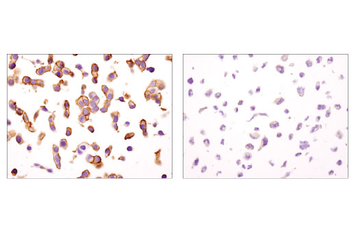 Immunohistochemistry Image 3: IGF-I Receptor β (D4O6W) Rabbit mAb (IHC Preferred)