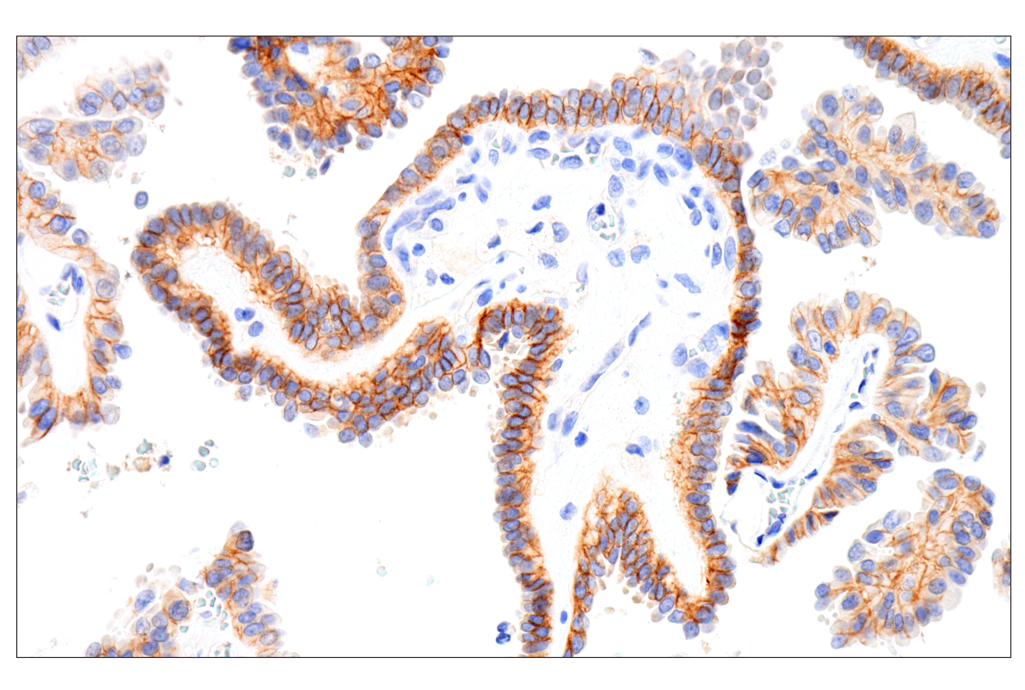 Immunohistochemistry Image 2: IGF-I Receptor β (D4O6W) Rabbit mAb