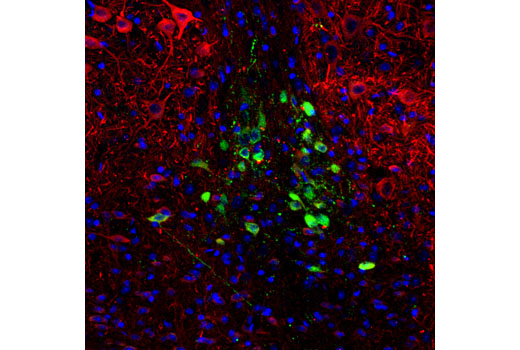 Immunofluorescence Image 1: CART (D6L8J) Rabbit mAb
