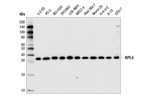 Western Blotting Image 1: RPL5 Antibody